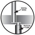 Shear Distal End Cutter (Long Handle)