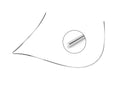 Reverse Curve Nickel Titanium Archwire (Round) (10 per pack)