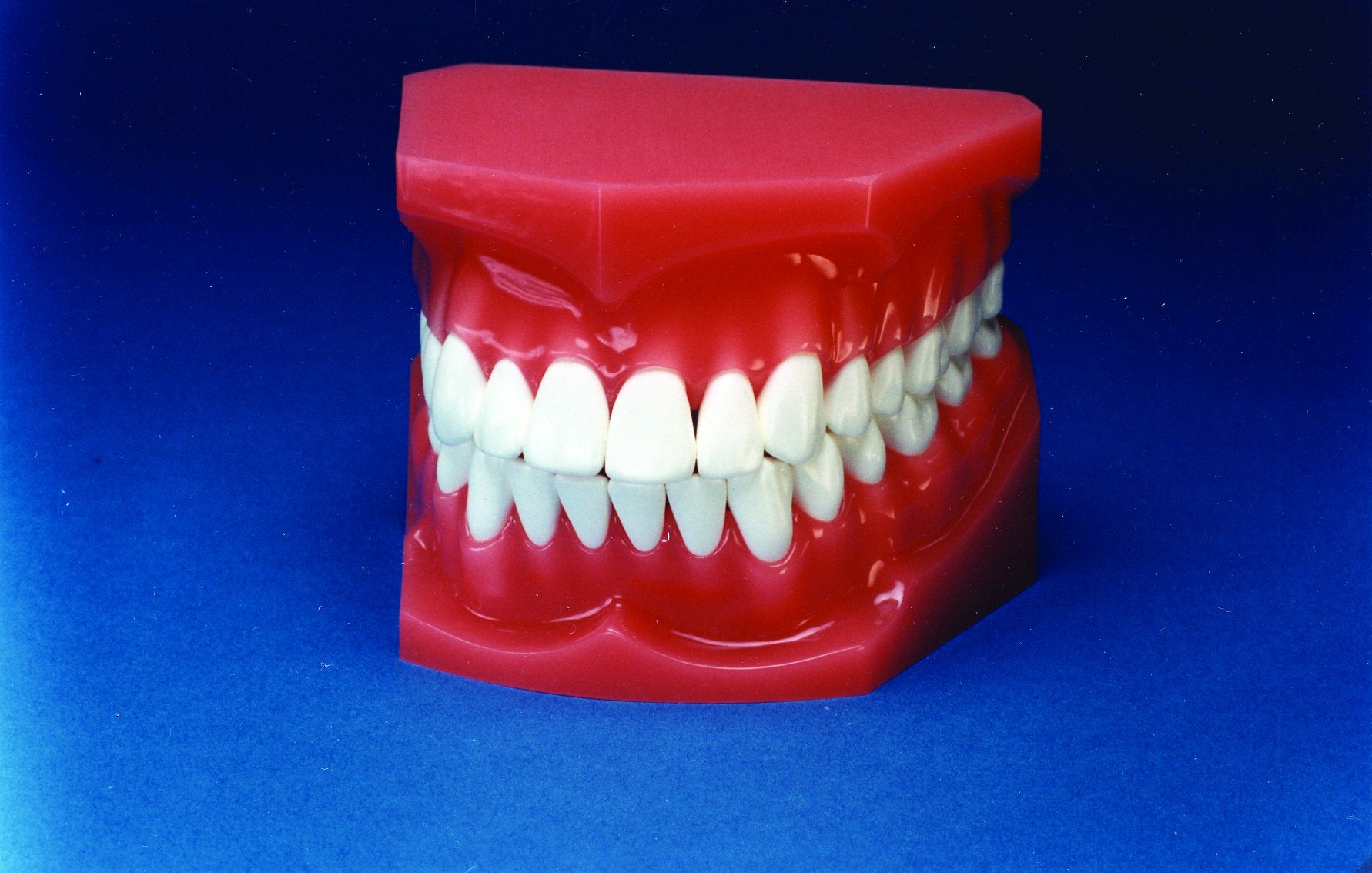 Typodont (Oversize 2 ½ X)