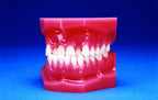Malocclusion Series (Solid) Class III