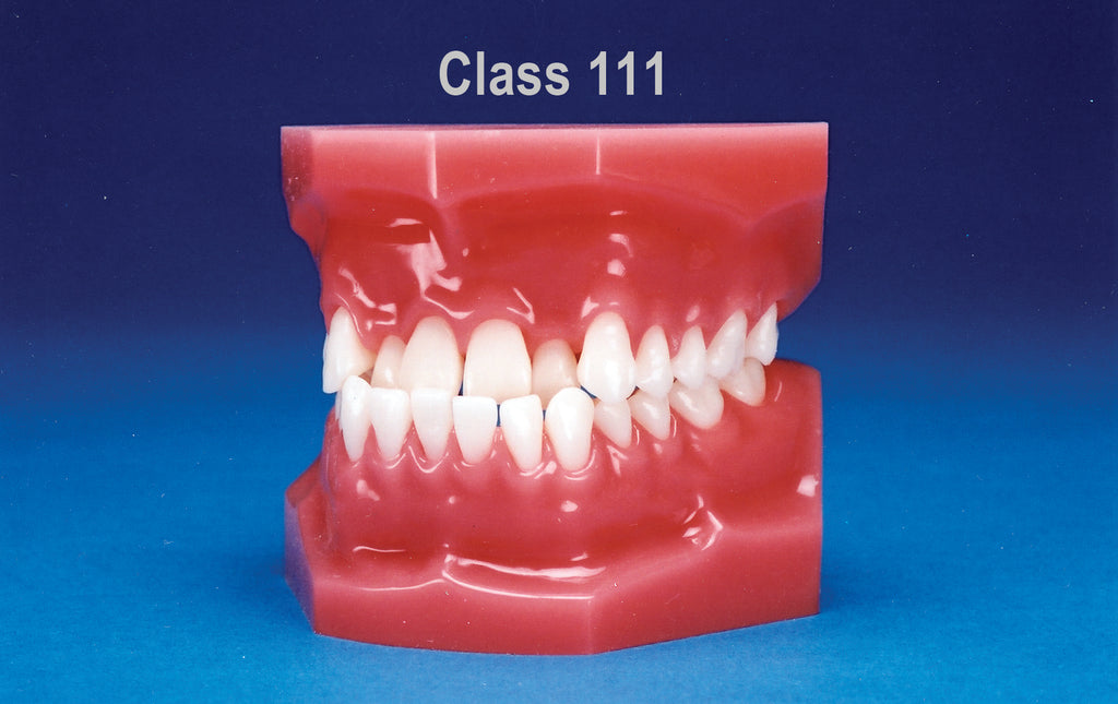 Malocclusion Series (Flexibase) Class III