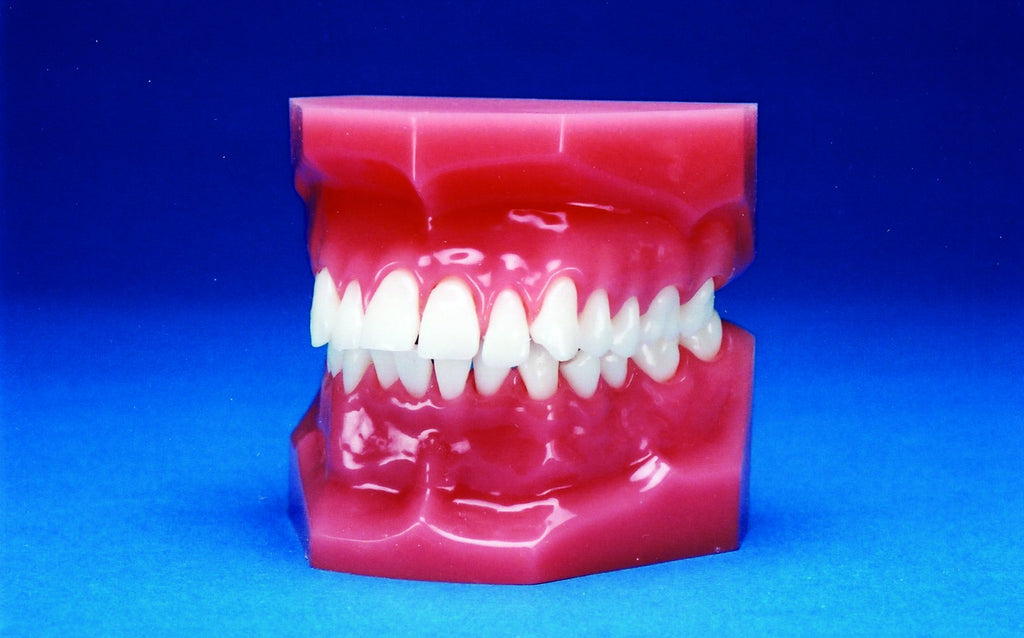 Malocclusion Series (Solid) Class II Division I