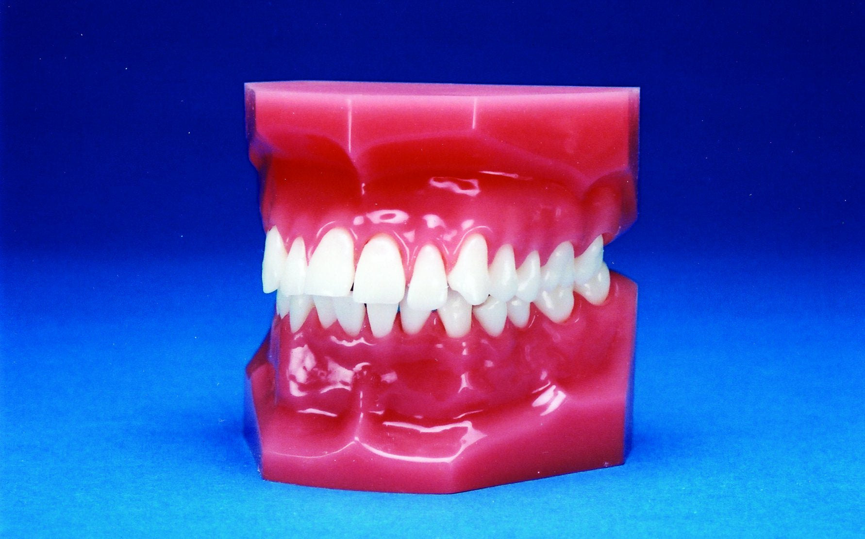 Malocclusion Series (Flexibase) Class II Division I