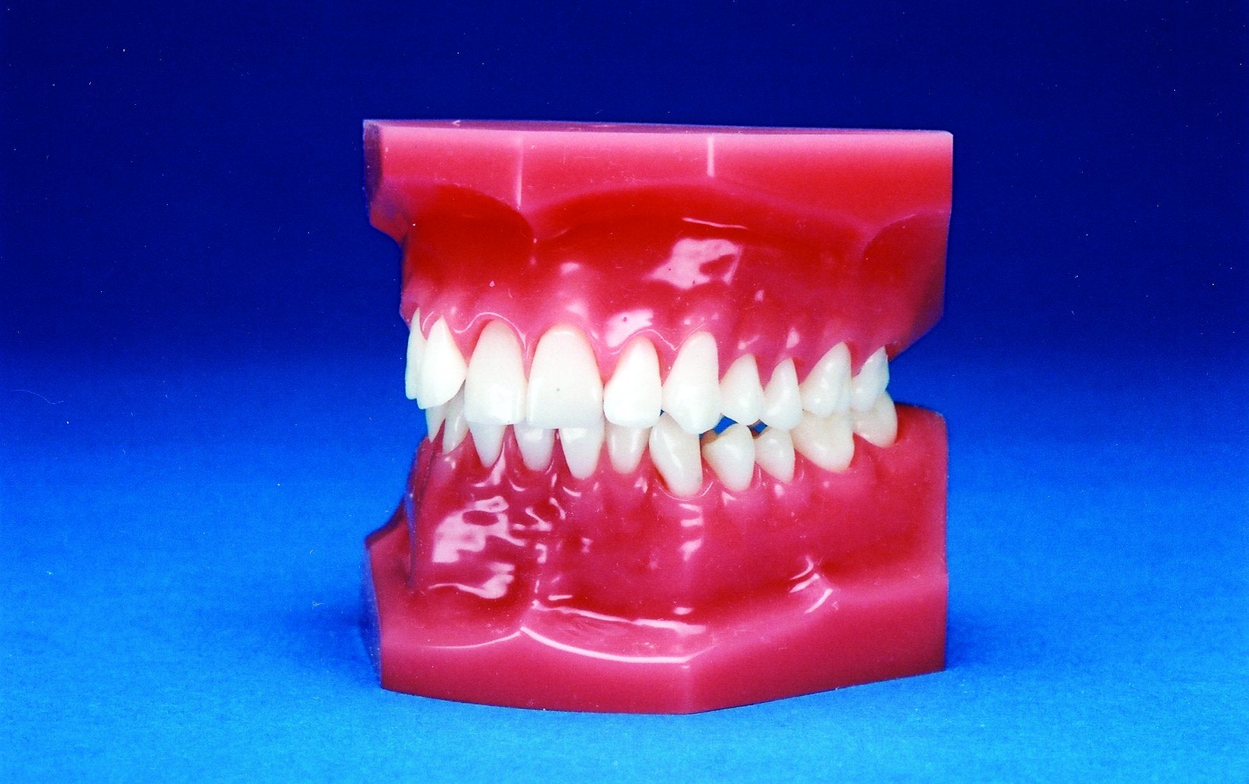 Malocclusion Series (Flexibase) Class II Division II