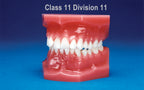Malocclusion Series (Flexibase) Class II Division II